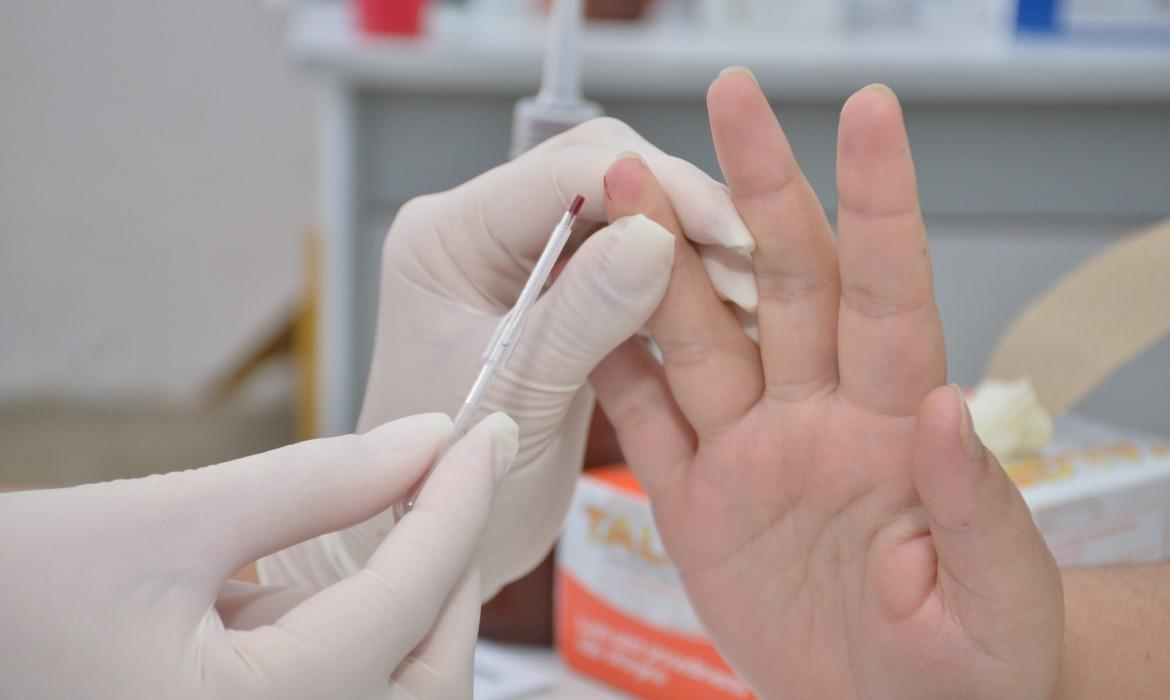 Saúde promove ação sobre Hepatites Virais na Unidade Vila Rica neste sábado (28) com testagem e vacinação